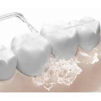 Xiaomi Water Flosser 2 MEO705 (белый, международная версия) Image #4